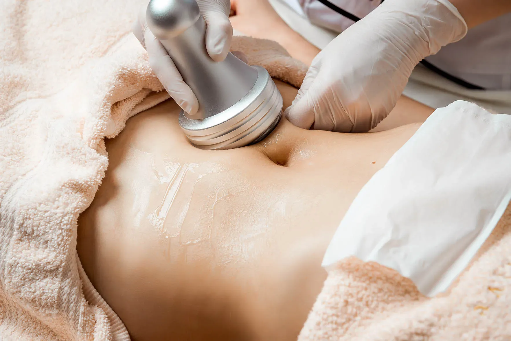 Fat Cavitation treatment